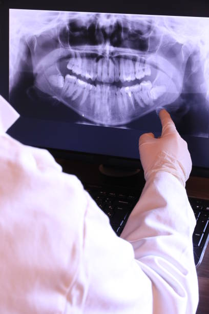 Best Broken or Chipped Tooth Repair in Black Earth, WI