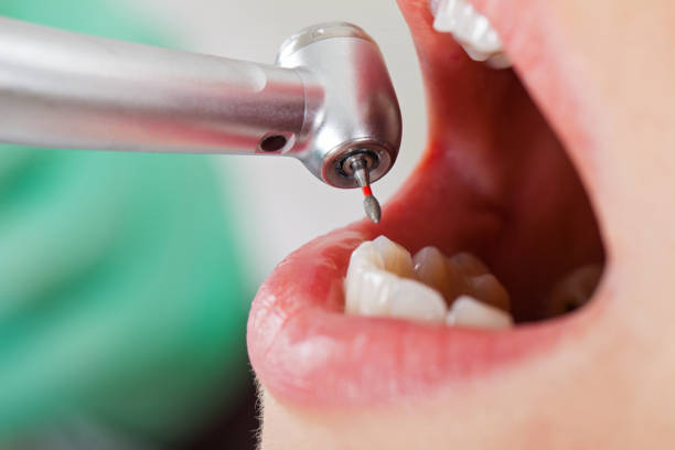 Best Urgent Dental Care for Toothaches in Black Earth, WI